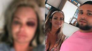 Mujer denunció que arriero la amenazó con machete y le pegó tan fuerte en la cabeza que sus ojos “salieron”