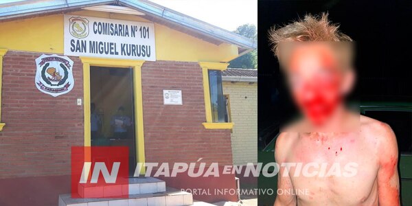HOMBRE FUE GOLPEADO BRUTALMENTE CON UN PALO EN CAMBYRETÁ - Itapúa Noticias