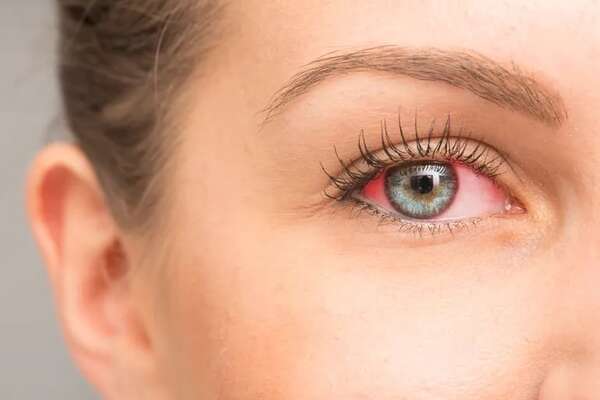 ¿Te Pican los Ojos? Por estos motivos no debés frotártelos - Estilo de vida - ABC Color