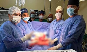 Extirpan tumor de 3 kilos a una paciente que dio a luz por cesárea – Prensa 5