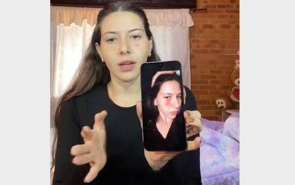 Futbolista olimpista habría golpeado a su ex pareja y ella cuenta cómo pasó