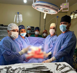 Equipo médico realiza extirpación exitosa de tumor de 3 kilos a paciente durante cesárea - trece