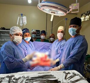 Mariscal Estigarribia: Extirparon tumor de 3 kilos de una mujer