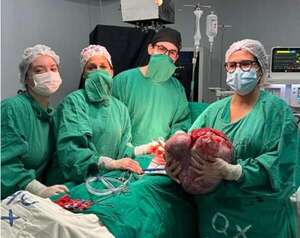 Extirpan un tumor de ovario de 15 kilos en el Incan - Nacionales - ABC Color