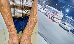 Motociclista ofuscado muele a golpes a un anciano porque no le habría dado paso en Asunción – Prensa 5