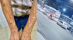 Violencia en el tránsito: Motociclista agrede brutalmente a un anciano en Asunción