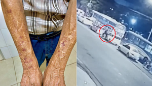 Motociclista ofuscado muele a golpes a un anciano porque no le habría dado paso