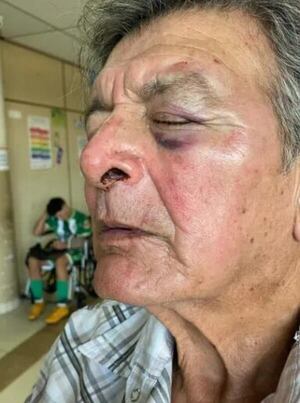 Video: hombre de 71 años fue agredido por supuestamente no dar paso a un motociclista - Policiales - ABC Color