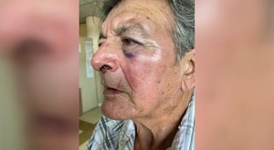 Motociclista agredió brutalmente a taxista por no darle paso en el tránsito, denuncian - trece