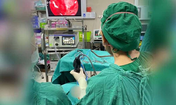 Encuentran más de 100 gusanos en la nariz de una mujer – Prensa 5