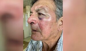 Abuelito fue agredido por un motoca y buscan al infeliz