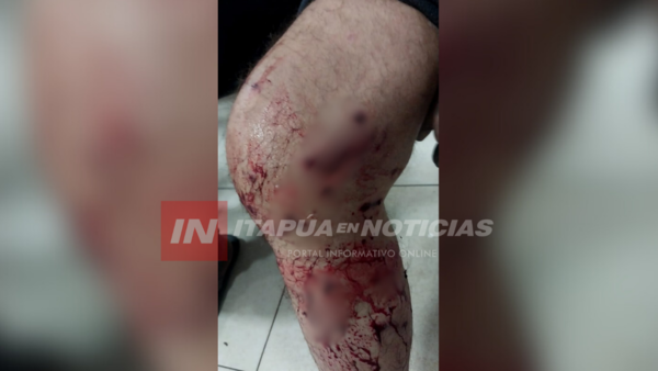 POR GS. 7.000 DISPARARON CON UNA ESCOPETA A UN HOMBRE EN ENCARNACIÓN - Itapúa Noticias