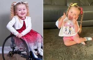¿Milagro de Dios?: dijeron que su hija viviría atada a una silla de ruedas; ahora los médicos están asombrados