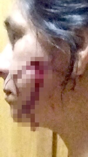 En noche de furia, un hombre hirió a su suegra y a su pareja en Presidente Franco - La Clave