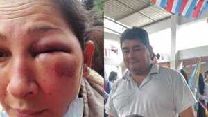 Brutal agresión a mujer en Cambyretá: piden que hombre sea procesado por sup. intento de feminicidio