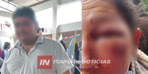 HOMBRE HABRÍA GOLPEADO BRUTALMENTE A SU PAREJA EN CAMBYRETÁ - Itapúa Noticias