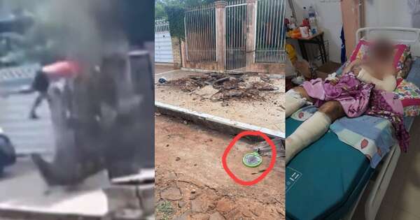 Diario HOY | Hombre quedó en grave estado tras explotarle en la cara el pozo ciego
