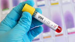 Avanzan hacia una vacuna eficaz frente al VIH gracias a una estrategia secuencial