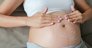 La Nación / La cesárea podría llevar a problemas de fertilidad, según estudio