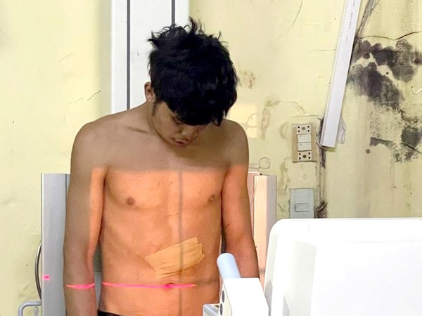 Detienen a adicto que hirió a su hermano con un destornillador y atacó a policías - La Clave