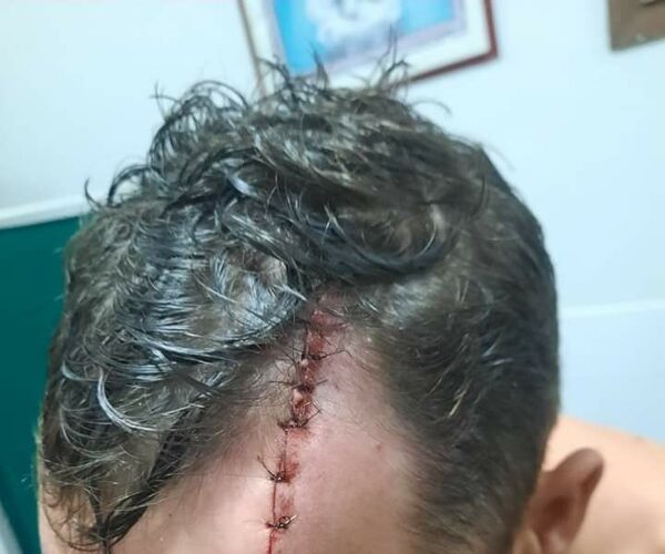 Mujer golpeó a su cuñado con un palo