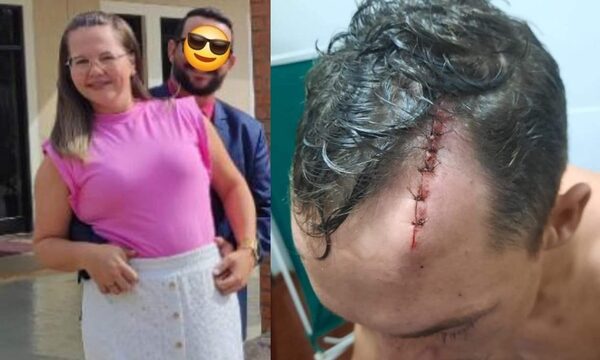 Furiosa mujer golpea a su cuñado en una cena familiar en Santa Rosa del Monday – Diario TNPRESS