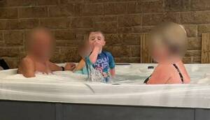 ¡Desesperante! Un filtro de jacuzzi succionó a un chiquito y lo lastimó