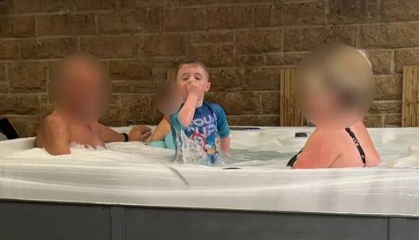 ¡Desesperante! Un filtro de jacuzzi succionó a un chiquito y lo lastimó