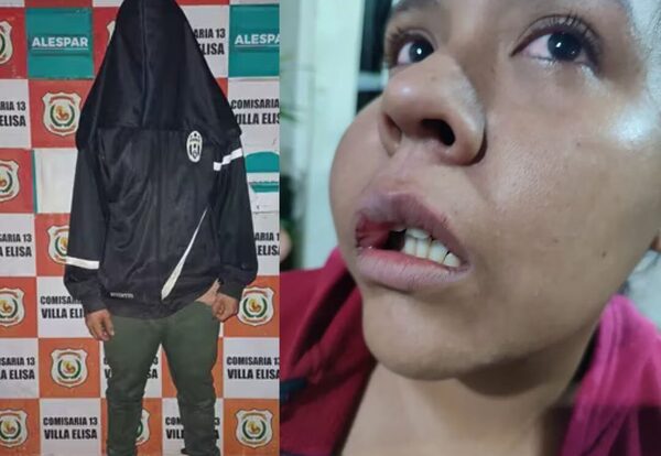 HOMBRE PATEÓ BRUTALMENTE A SU CUÑADA TRAS DISPUTA POR VIVIENDA