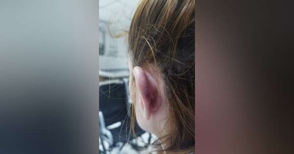 Diario HOY | Víctima de violencia familiar teme por su vida: “Intenté matarme por lo mal que me hacía sentir”