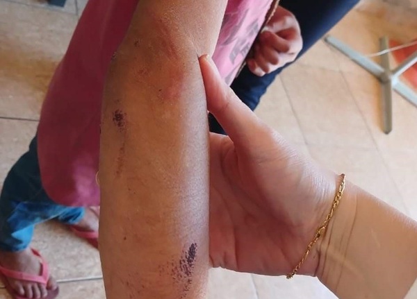 Denuncian brutal golpiza a una niña en Coronel Oviedo - Noticiero Paraguay