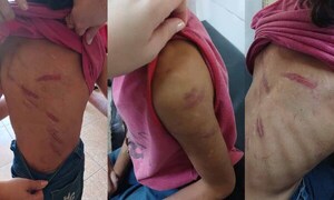 Mujer golpeó brutalmente a su hija de 8 años en Coronel Oviedo – Prensa 5