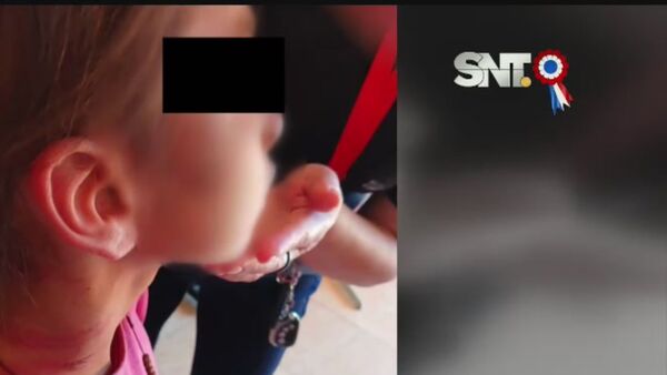 Extrema violencia contra una niña en Coronel Oviedo - SNT