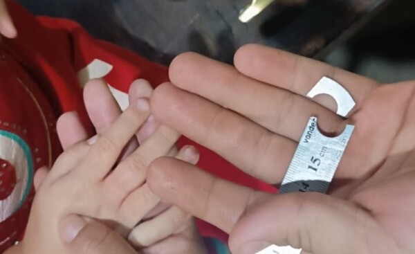 Bomberos sacan regla atascada en dedo de niña de 3 años