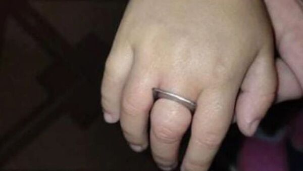Regla de metal queda atascada en el dedo de una niña de 3 años