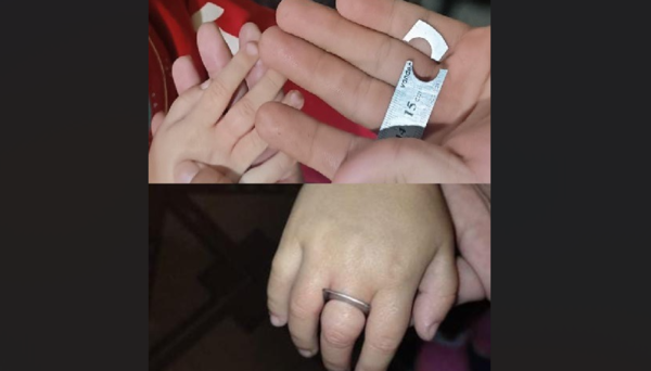 Bomberos extraen regla metálica atascada en el dedo de una niña de 3 años - ADN Digital