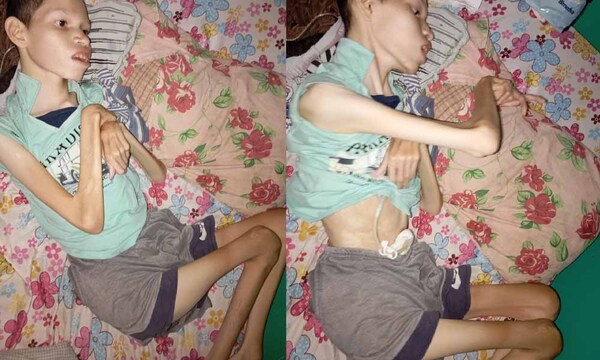 Madre pide una estufa para su hijo con discapacidad en Coronel Oviedo – Prensa 5