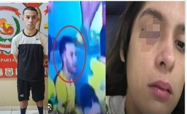 Detenido por herir a fotógrafa en el ojo de un honditazo