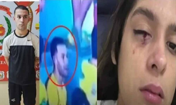 Detienen a barrabrava que hirió de un honditazo a una mujer en Coronel Oviedo – Prensa 5