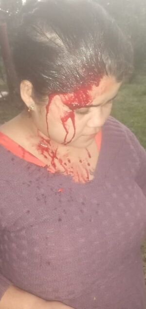 Joven Denuncia a Concejal Municipal de San Alfredo por Supuesta Agresión