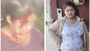 Denunció a concejala de golpearla con palo