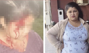 SALVAJE CONCEJAL ATACA A SU VECINA CON UN GARROTE Y LE ROMPE LA CABEZA