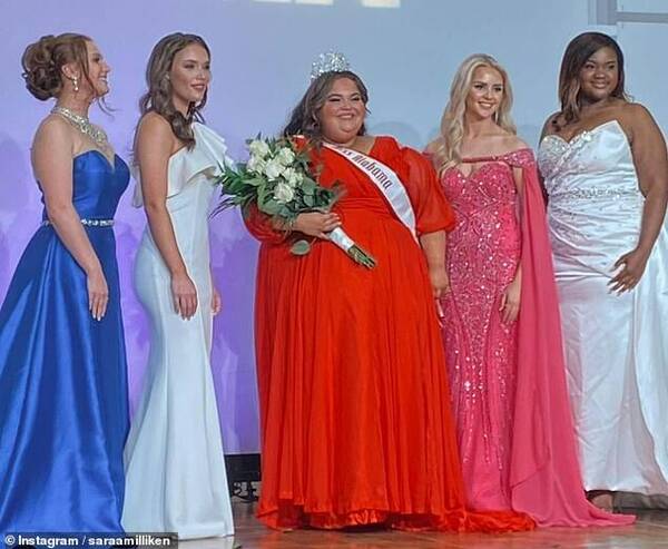 [VIDEO] Mujer con obesidad ganó la corona de "Miss Universo Alabama"