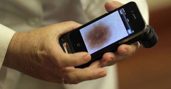 Diario HOY | Melanoma: es clave no exponerse al sol en horario no adecuado