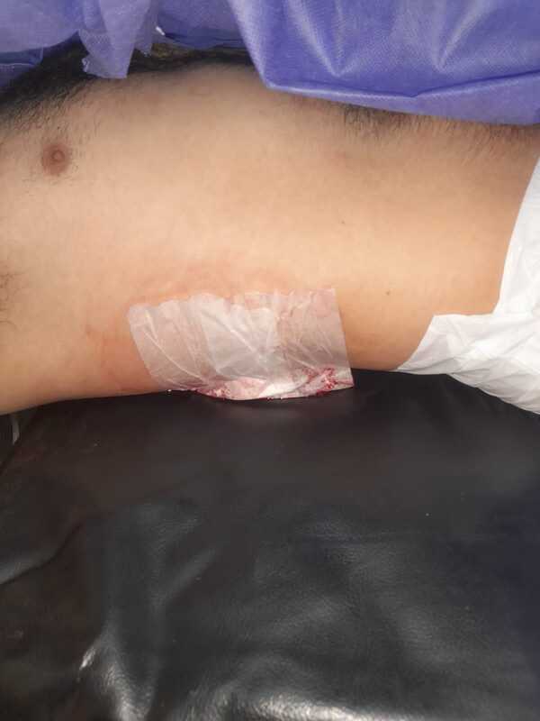 Riña deja un herido en conocido bar de Encarnación