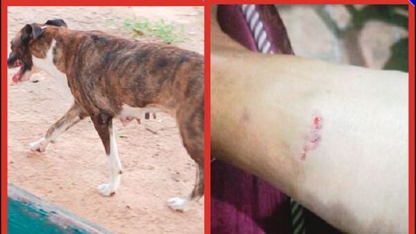 Perros sueltos atacan a vecinos de Barrio Obrero