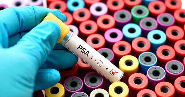 La Nación / El cáncer de próstata causa más de 500 fallecimientos al año en el país
