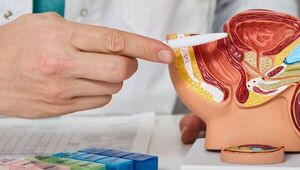 Una luz contra el cáncer de próstata: Científicos usan tinte fluorescente para eliminarlo totalmente