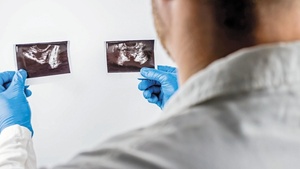 “Cáncer de próstata no presenta síntomas”: médico insta a los hombres a la consulta temprana