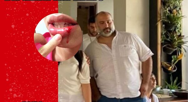 GOLPEABA A SU NOVIA PORQUE SE DEPILABA AHÍ ABAJO
